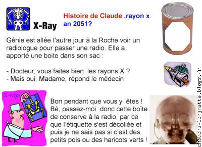 histoire de Claude : rayon X