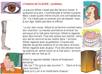 histoire de Claude : prothèses